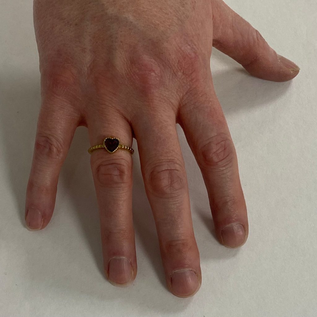Wearing the ring once fixed